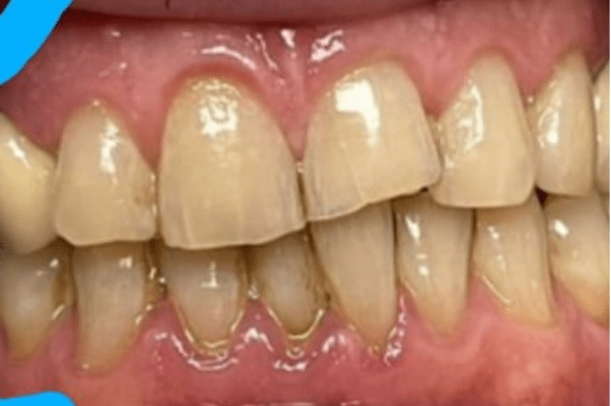 Rehabilitación Oral