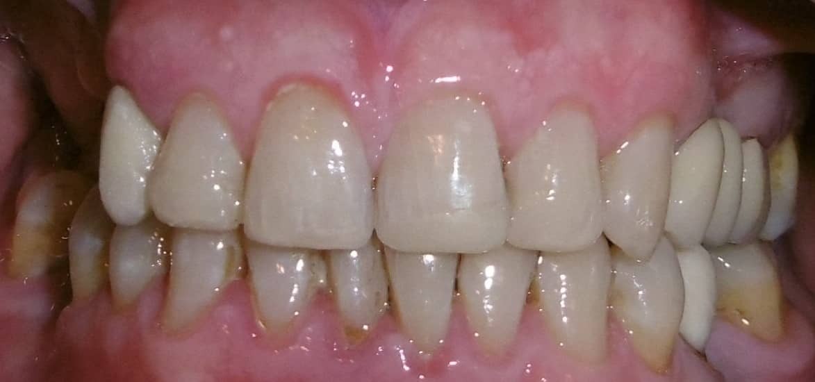 Rehabilitación Oral